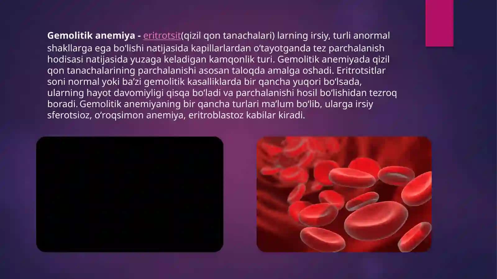 Gemolitik Anemiya 3