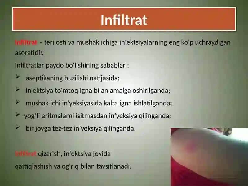 In'ektsiyadan keyingi asoratlar 3