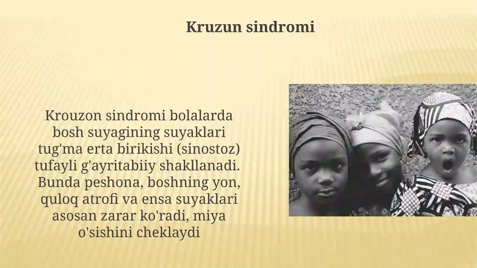Yosh bolalar kalla ешиииsuyaklarining xususiyatlari. Rivojlanishdagi anomaliyalari 3