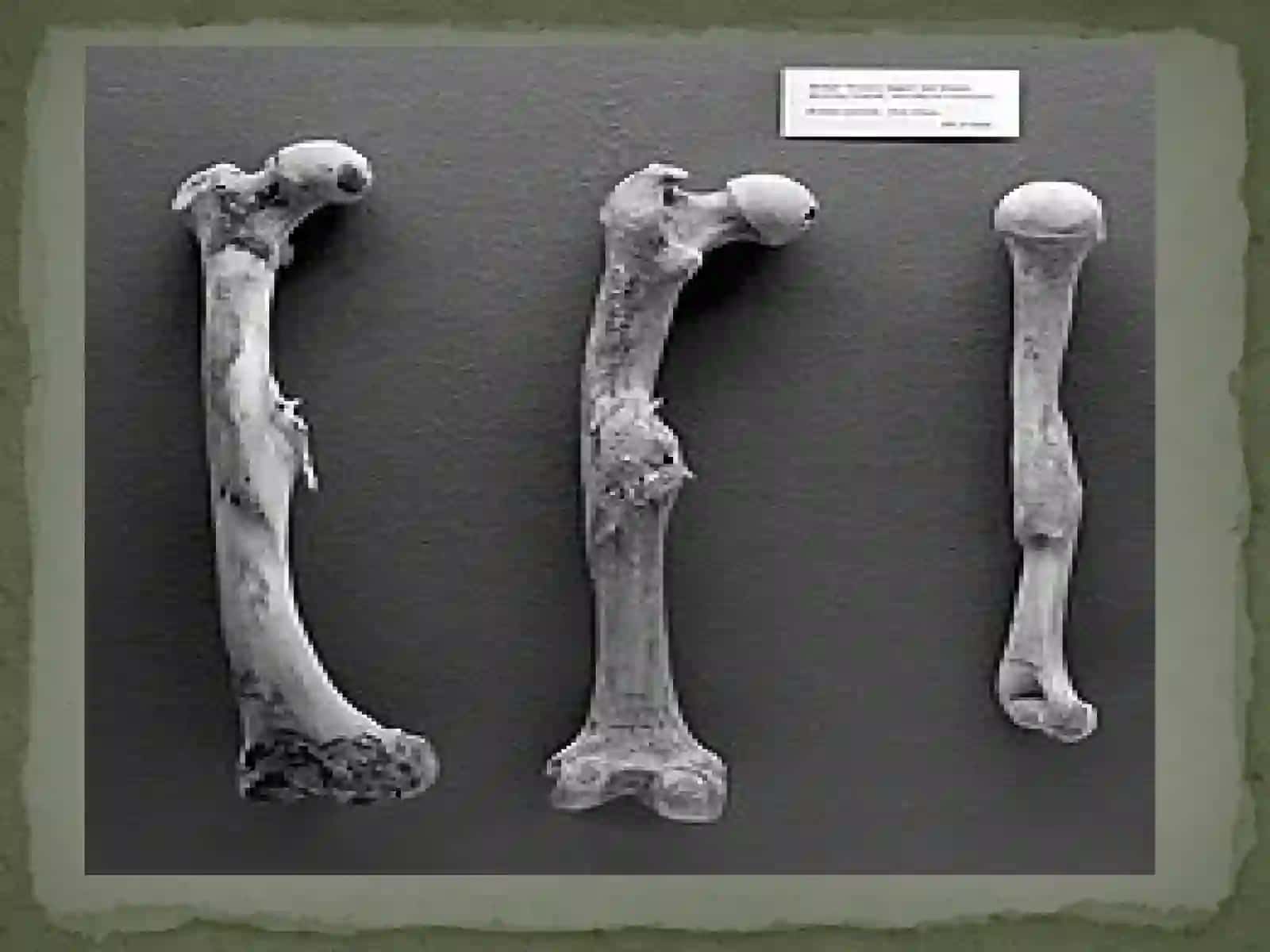 Sikilet toʻqimasi.(Suyak toʻqimasi) 3
