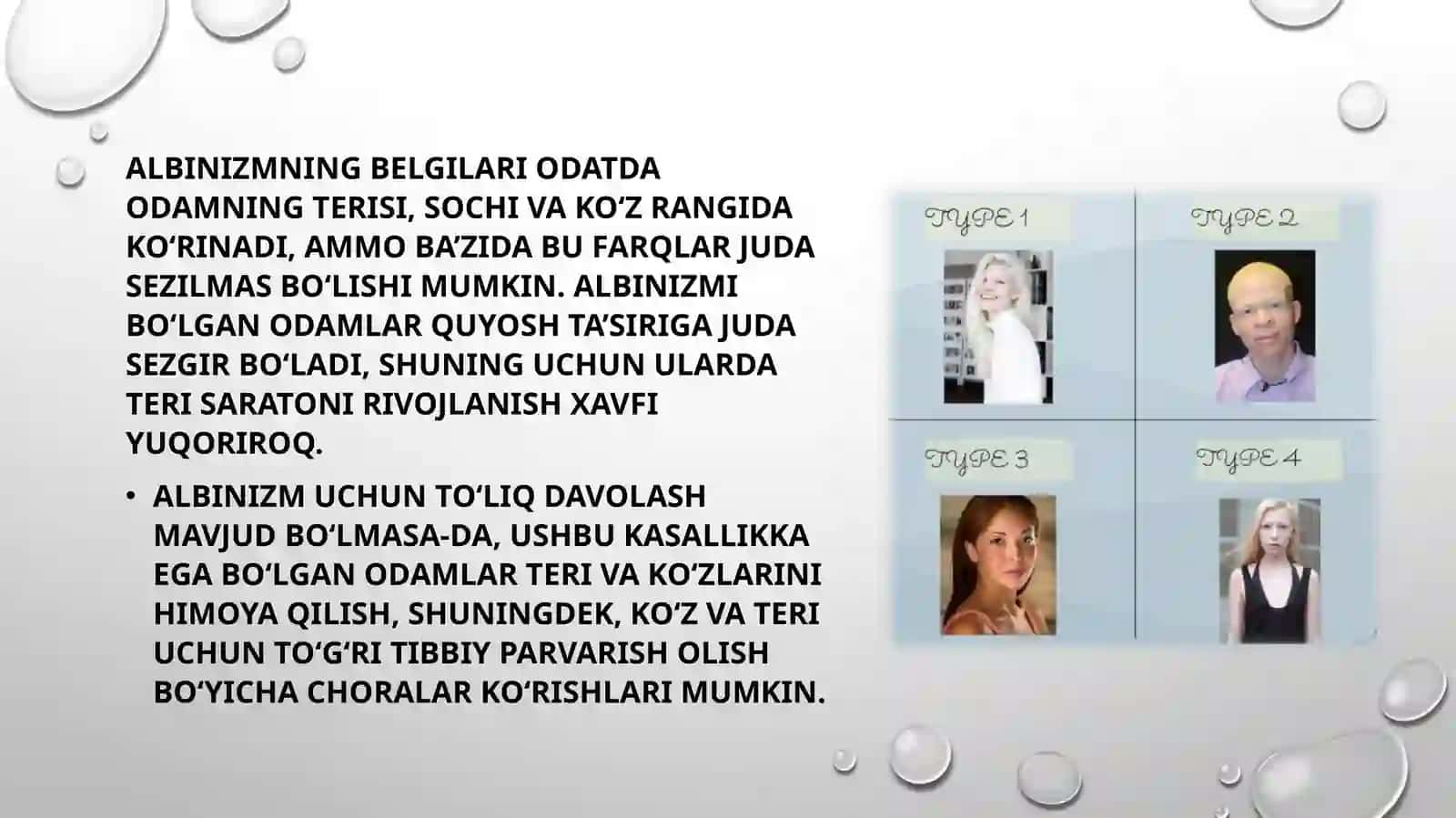 Albinizm. Etiopatogenezi, klinikasi, diagnostikasi, davolash va profilaktikasi 3