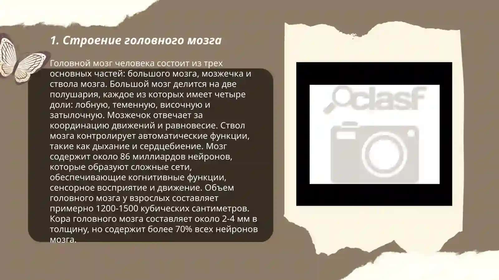 Головной мозг 3