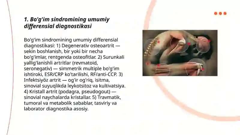 Bo’g’im sindromi qiyosiy diagnostikasi 3