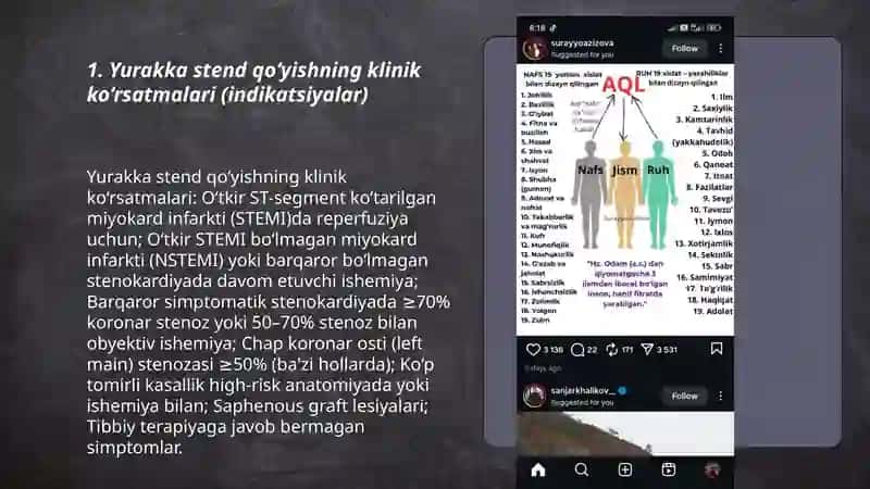 Yurakka stend qo‘yish 3