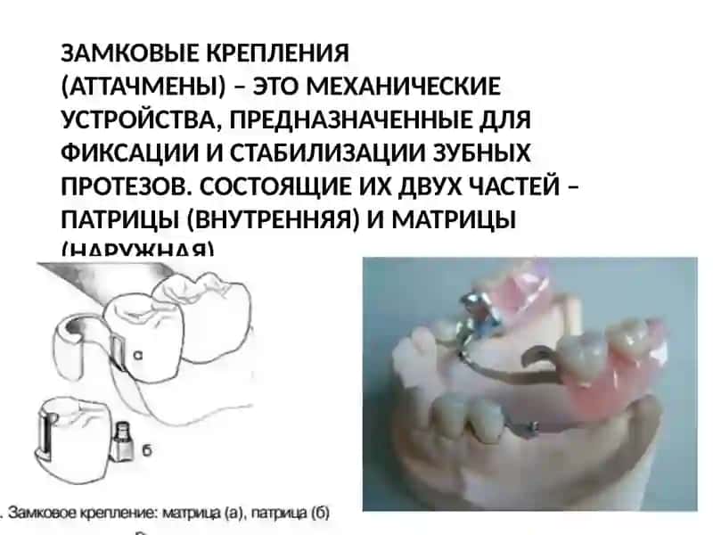 Аттачменлар 3