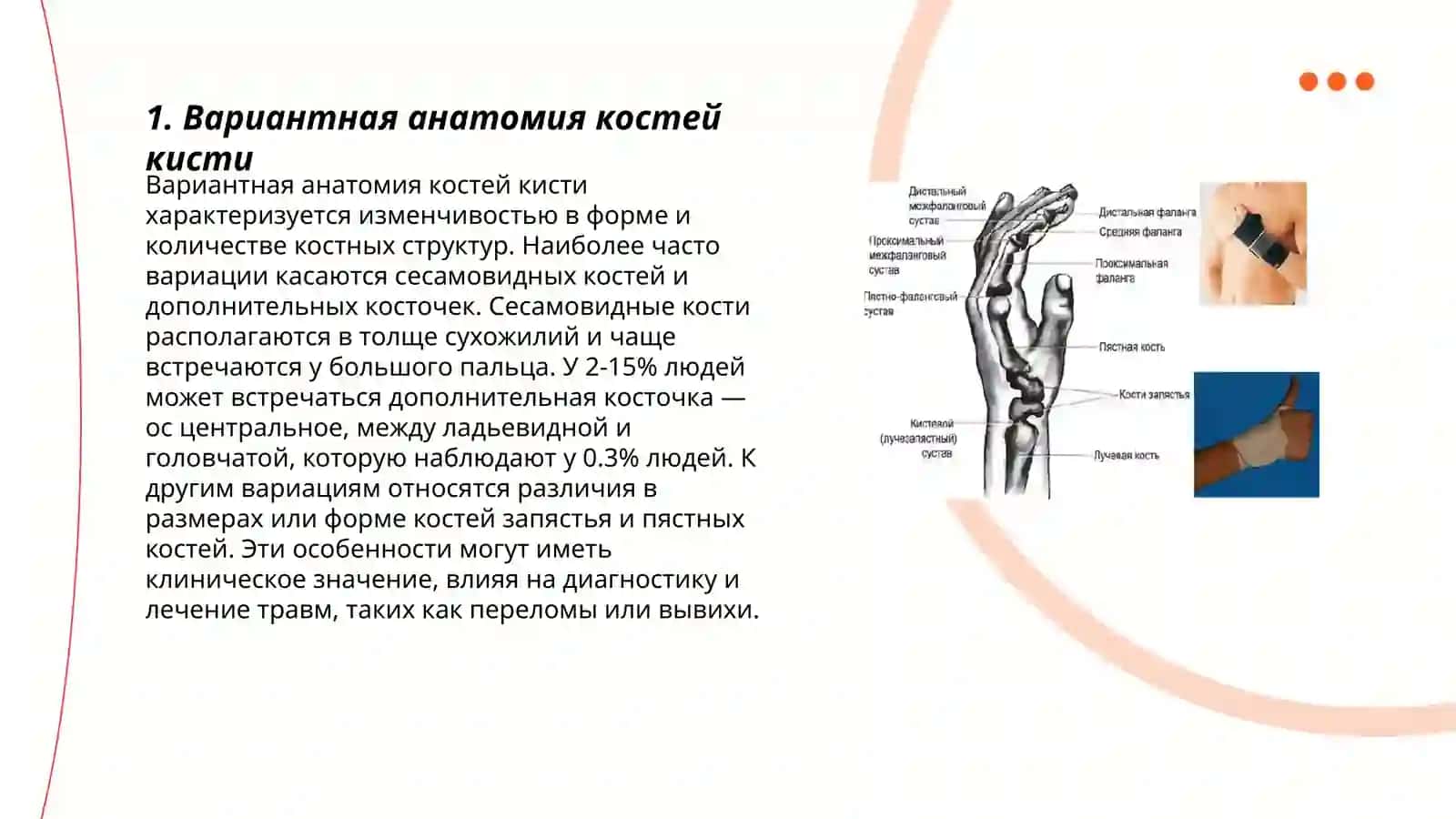 Вариантная анатомия костей кисти, пороки развития, влияние внутренних и внешних факторов на развитие костей кисти 3