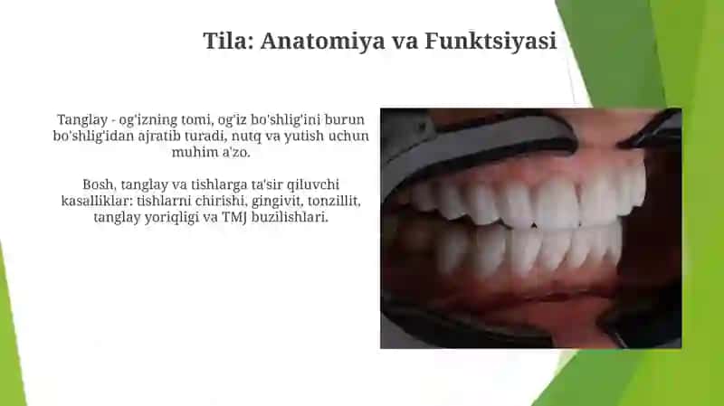 A'zo va bosh qismlarini ifodalovchi dubletlar va ularning patalogiyasining nomlari(Bosh,tanglay,tish) 3