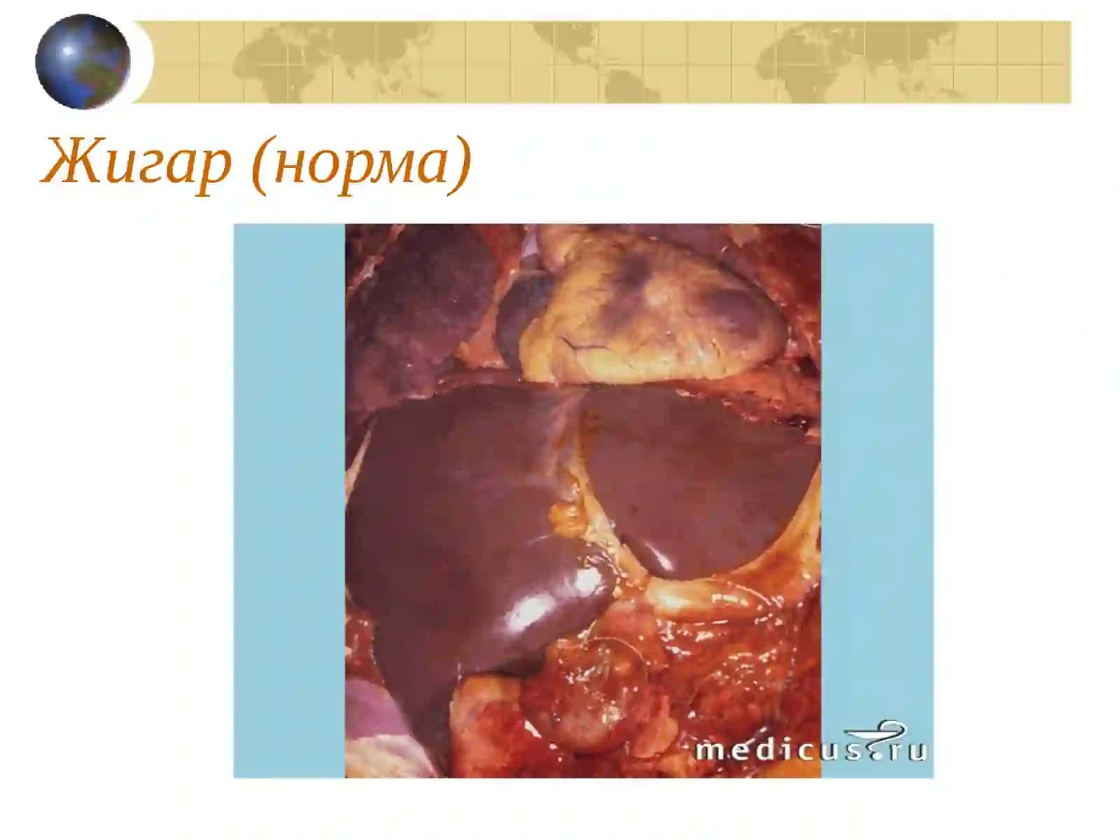 Сурункали гепатит 3