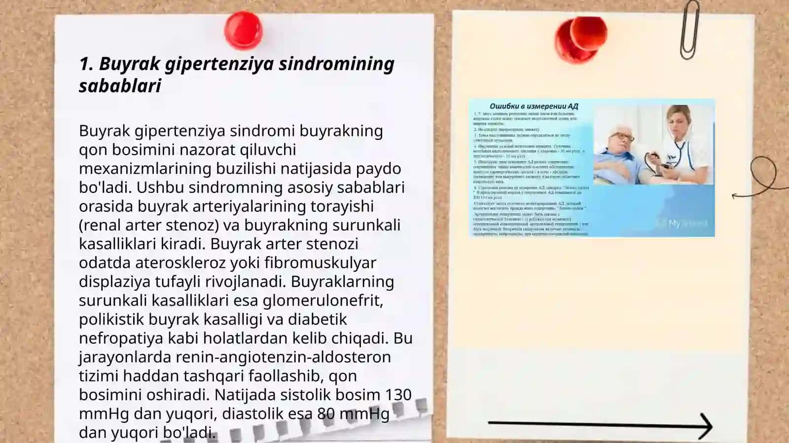 Buyrak gipertenziya sindromi 3