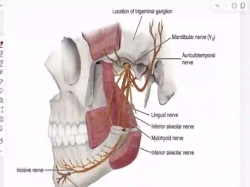Mandibulyar anesteziya 3