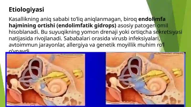 Mener kasalligi va zamonaviy davolash usullari 3