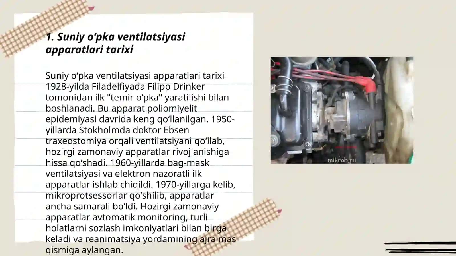 Suniy oʻpka ventilatsiyasi apparatlari tarixi 3