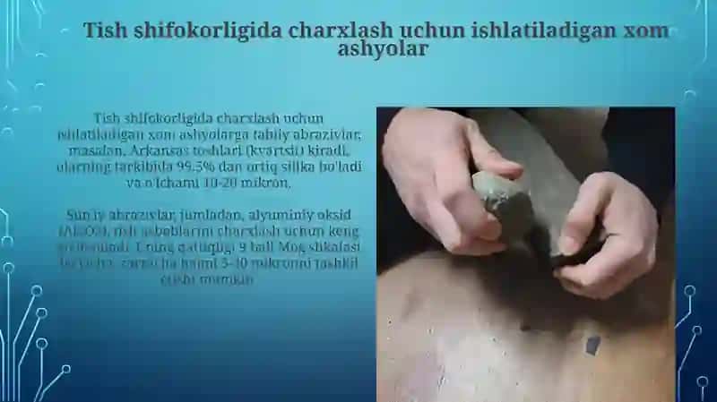 Tish shifokorligida charxlash uchun ishlatiladigan xom ashyolar 3