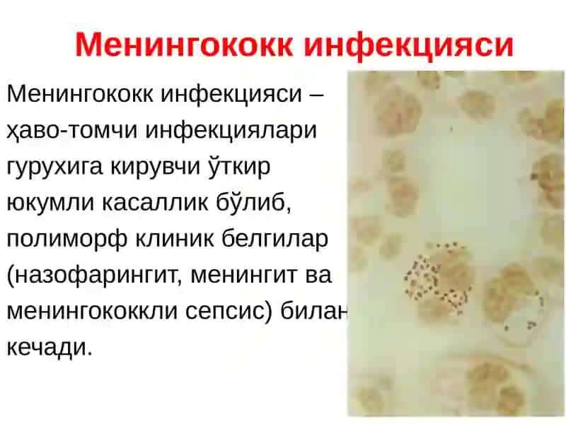 Менингококкинфекцияси 3