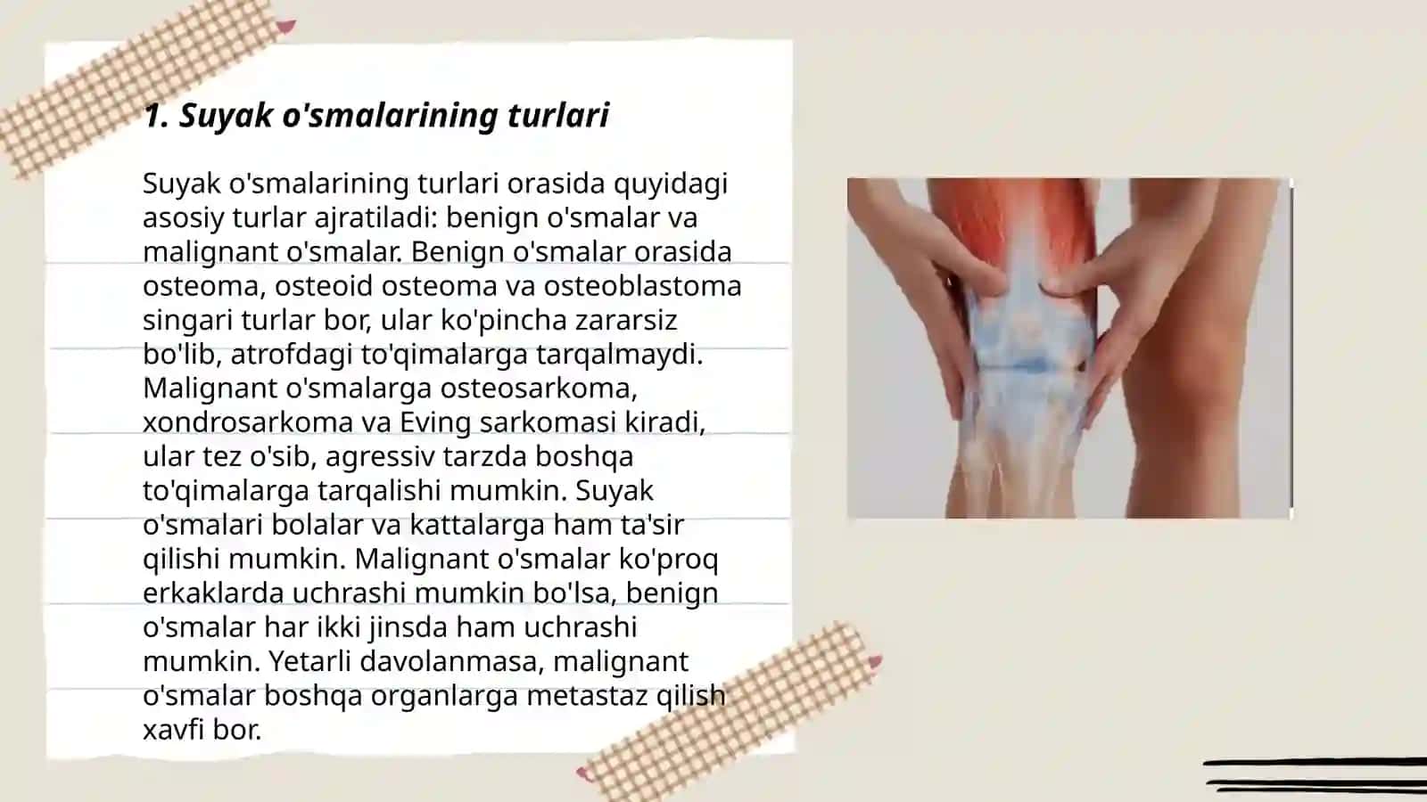 Suyak o'smalari. Artrozlar va artritlar. Bo'g'imlar o'smalari. Yumshoq to'qimalar o'smalari 3