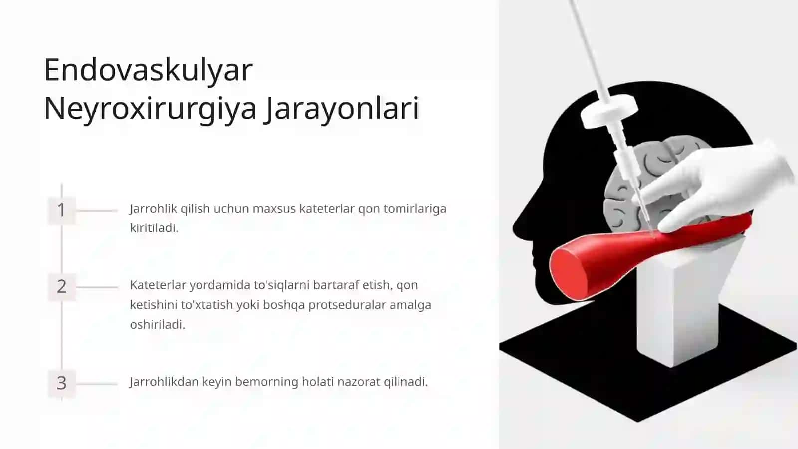 Endovaskulyar Neyroxirurgiya 3