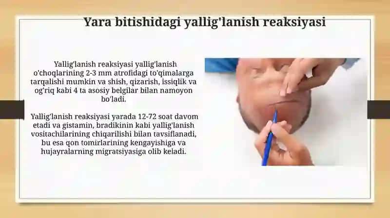 Fibroblastlarning jatohatning bitishi va chandiq hosil bòlishidagi òrni 3