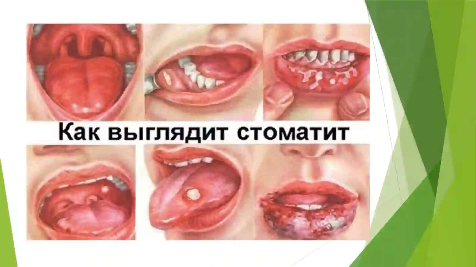 Yoshga doir og’iz bo’shlig’i, halqum, qizilo’ngach anatamo-fiziologik xususiyatlari 3