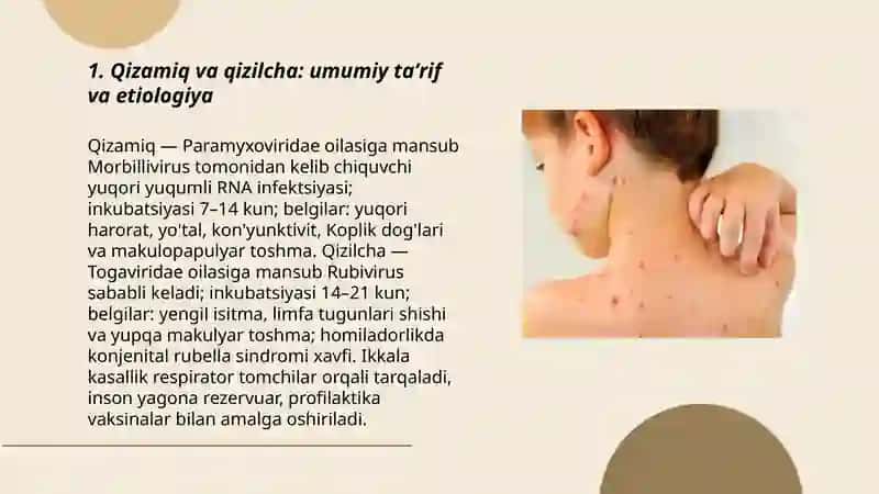 Qizamiq va qizilcha: umumiy taʼrif va etiologiya 3