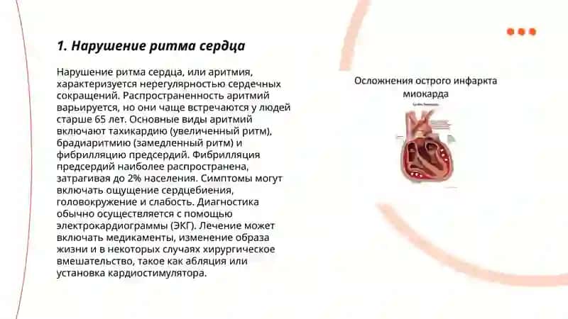 Осложнения инфаркта миокарда 3