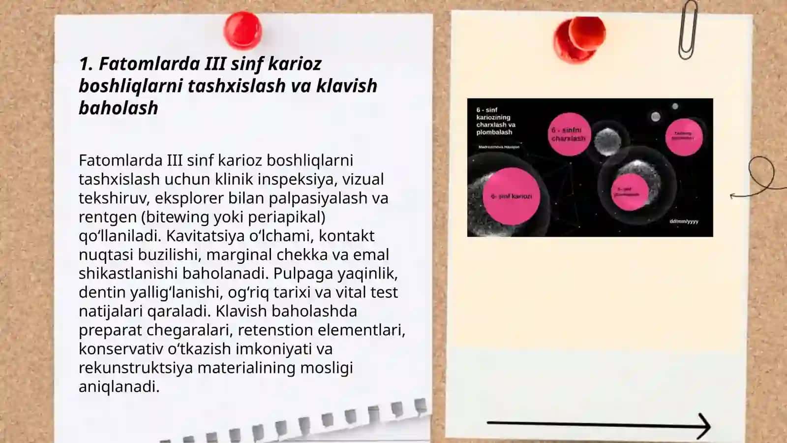 Fatomlar III sinf karioz boshliqlarni charixlash va plombalash 3