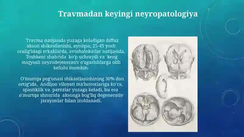 Nevropatologiya 3