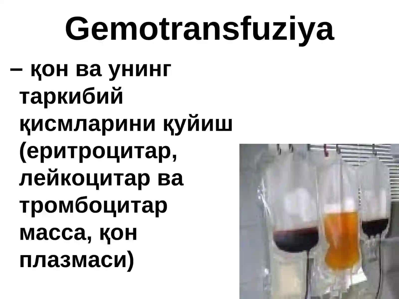QON QUYISH. TRANSFUZIOLOGIYANI ZAMONAVIY ASPEKTLARI 3