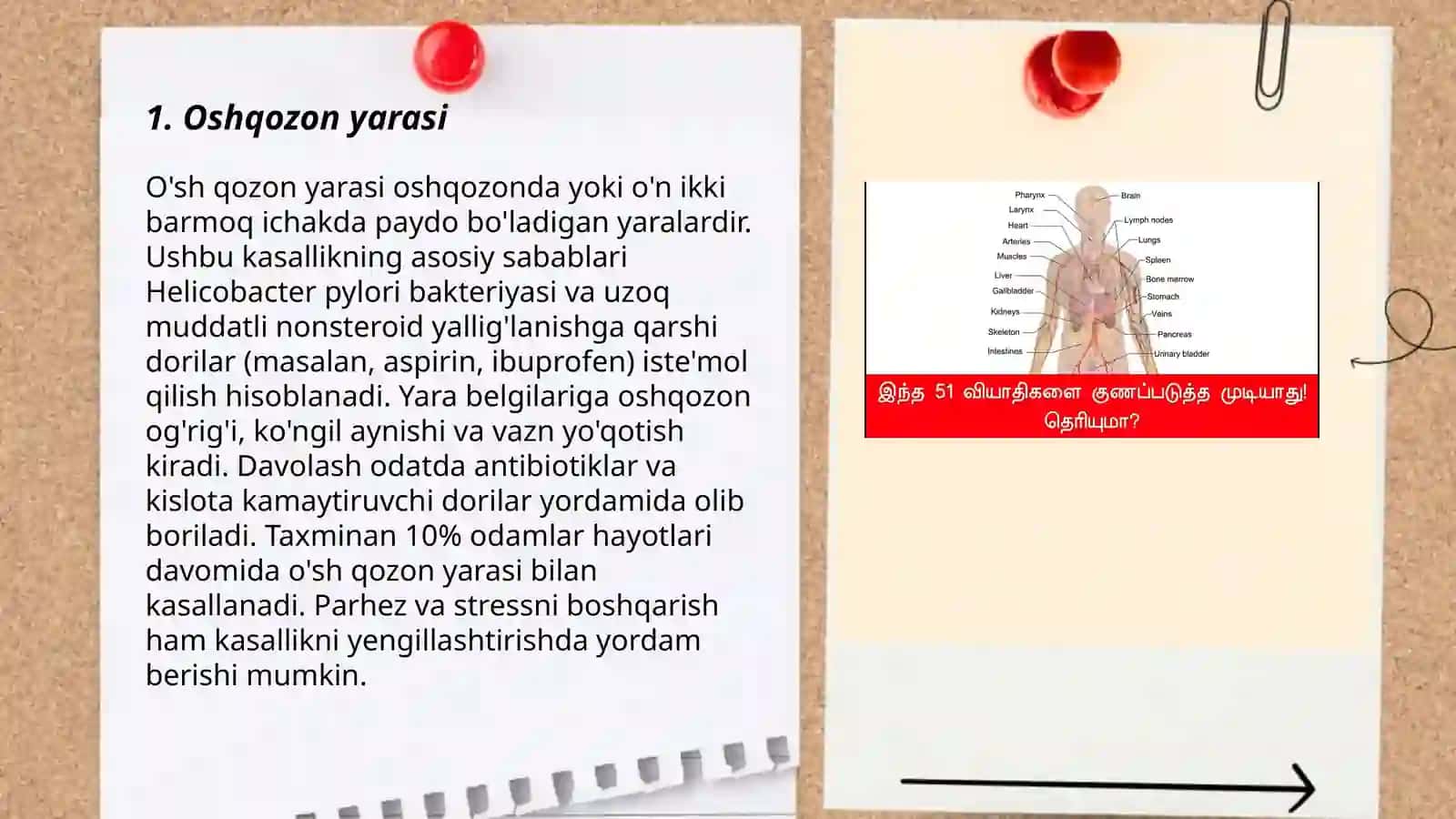 Oshqozon 12 barmoq kasalliklari 3