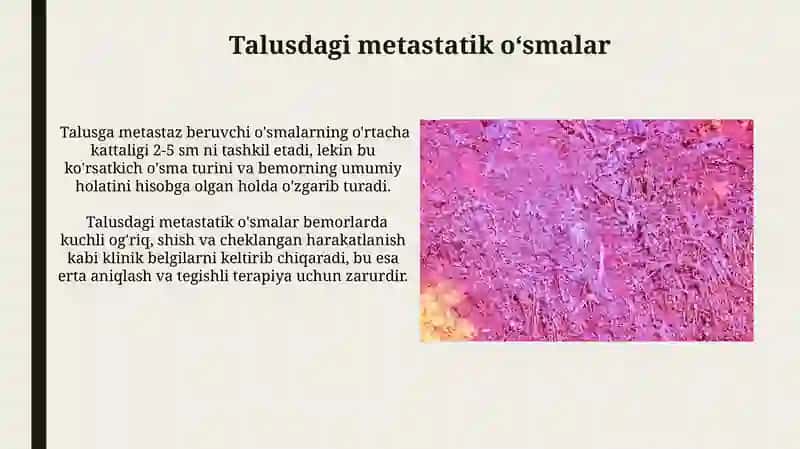 Taluqning tug'ma anomaliyalari va o'smalari 3
