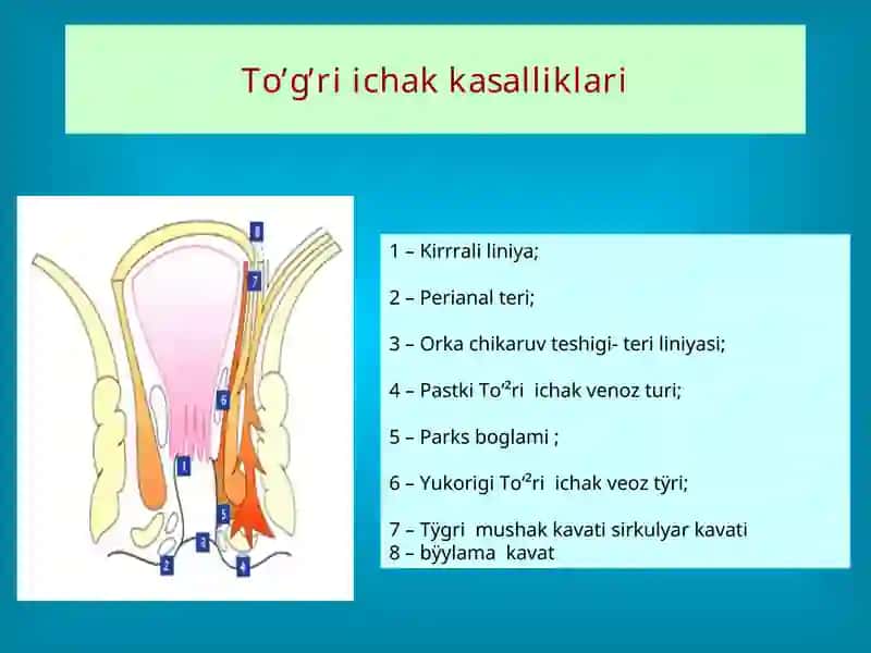 To’g’ri ichak kasalliklari 3