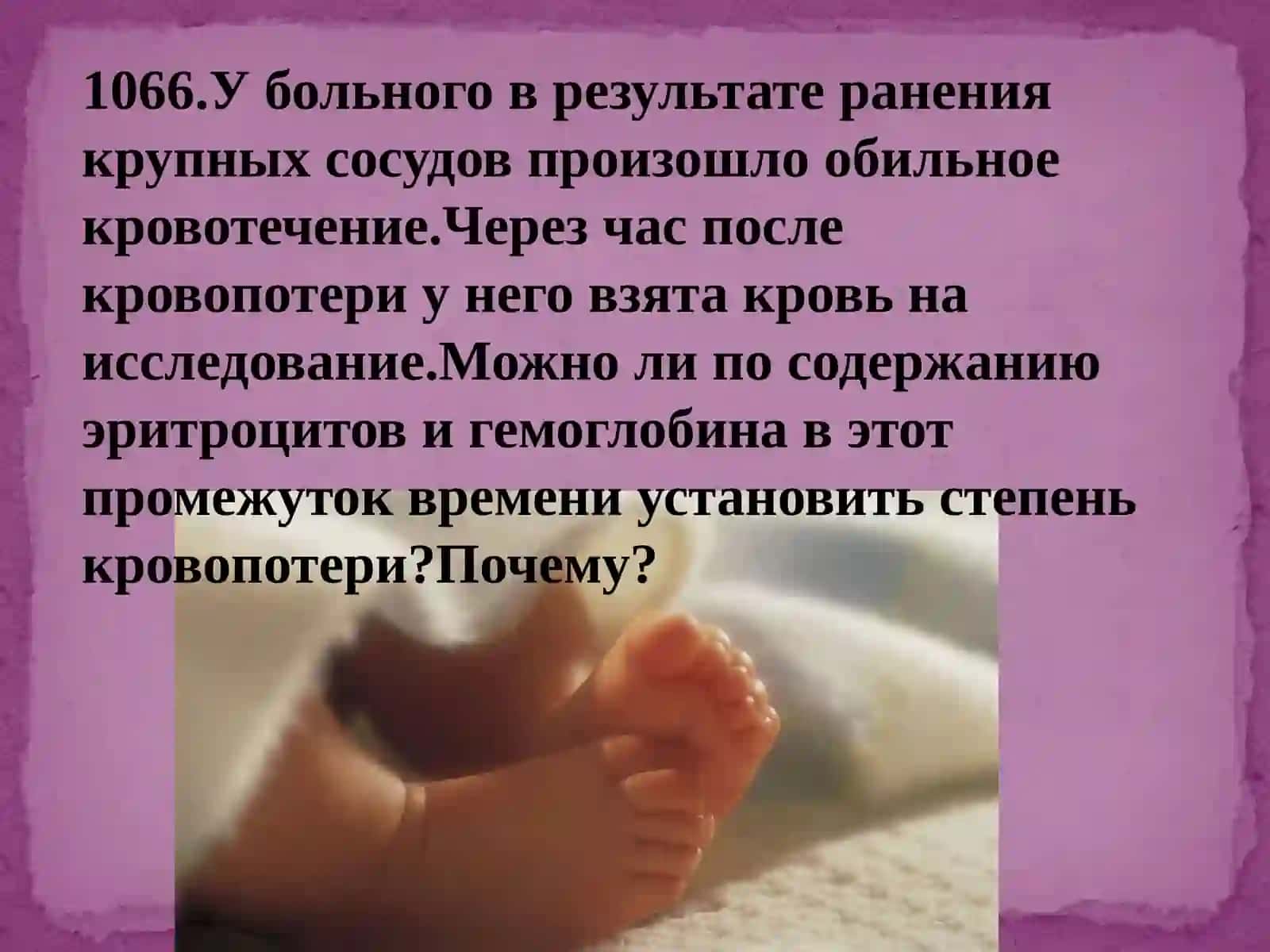 Анемии 3