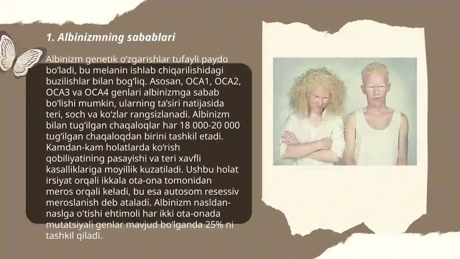 Albinizm kasalligi 3