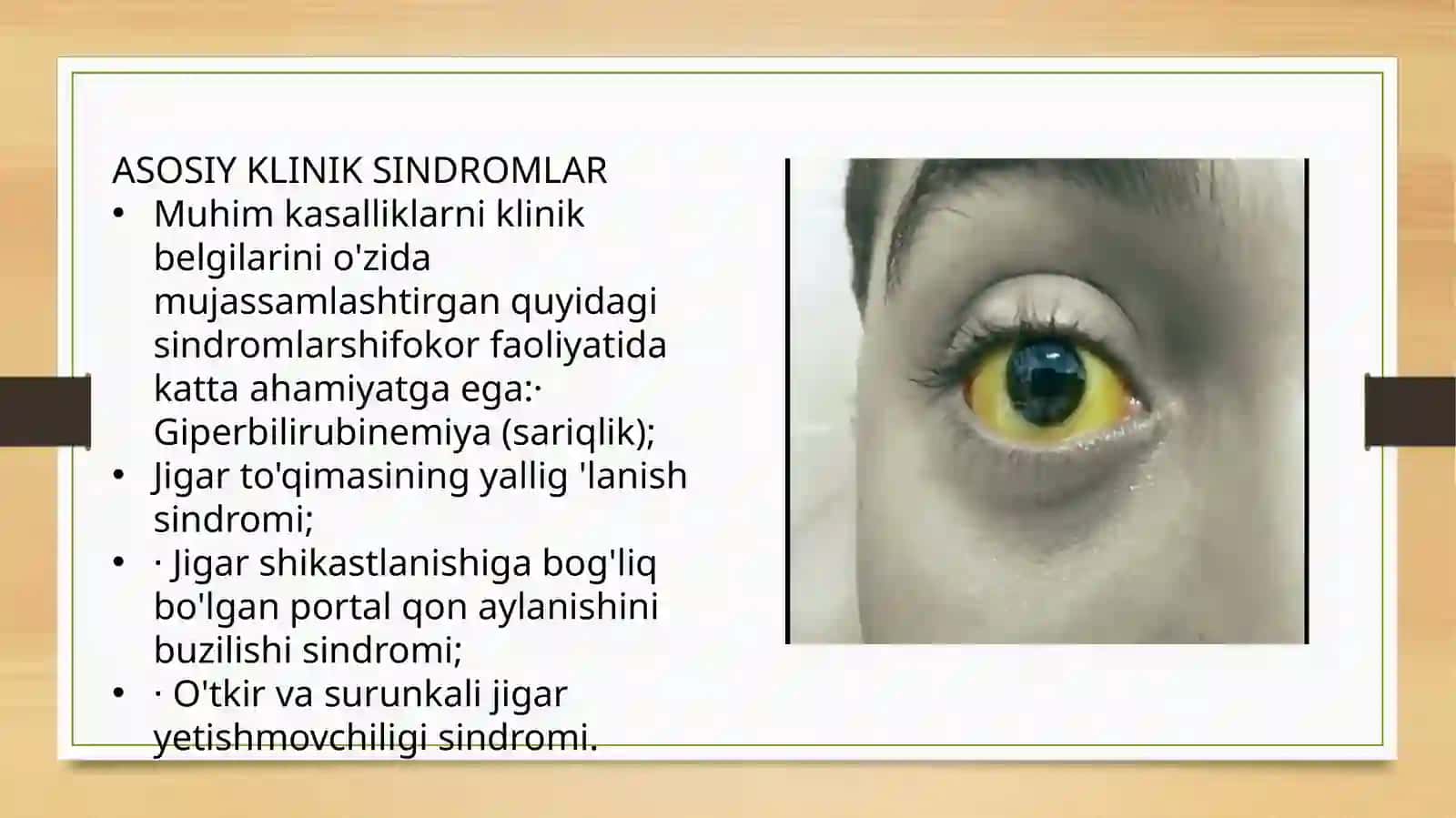 Jigar va o't yo'llari. Asosiy 2 klinik sindromlar sariqlik, portal gipertenziya, jigar yetishmovchil 3
