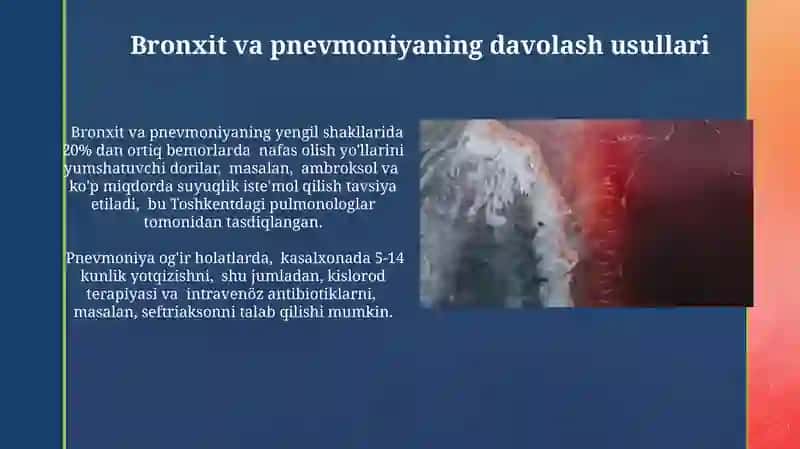 Bronxit pnevmoniya zotiljam 3