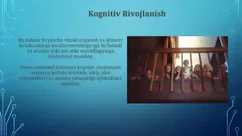 Daun sindiromli bolalarning xususiyati 3