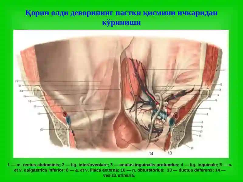 Чов, сон, киндик ва қорин оқ чизиғи чурралари 3