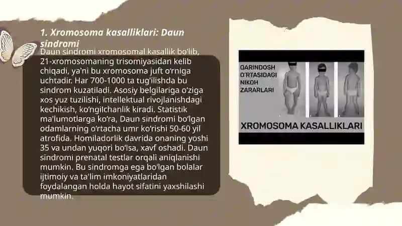 Irsiy kasalliklar 3