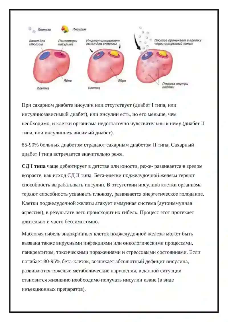 Сахарный диабет 3