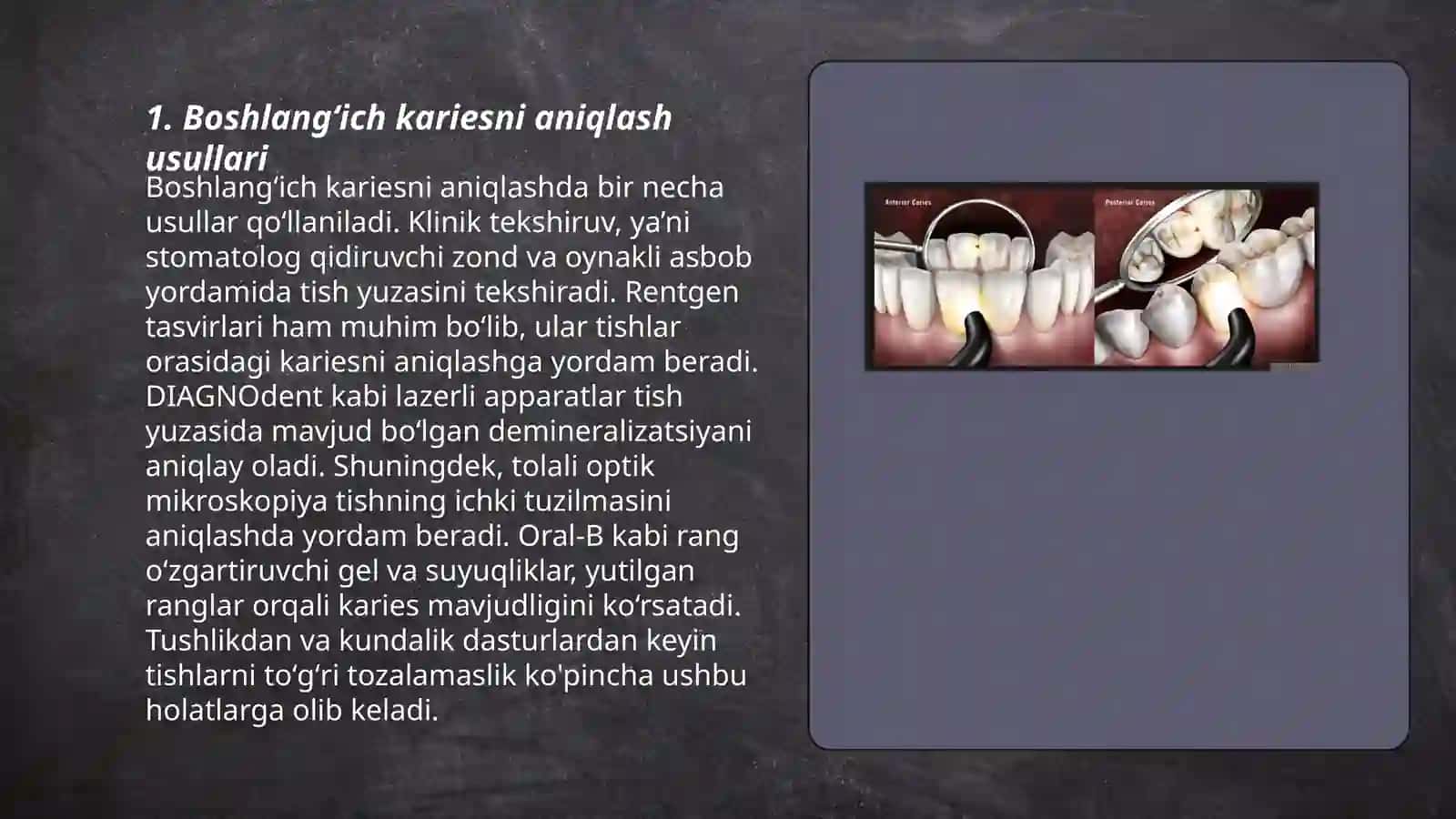 Boshlangʻich (oq dogʻ davri) va yuza kariesni mahalliy (ekzogen) va umumiy (endogen) davolash usullari 3