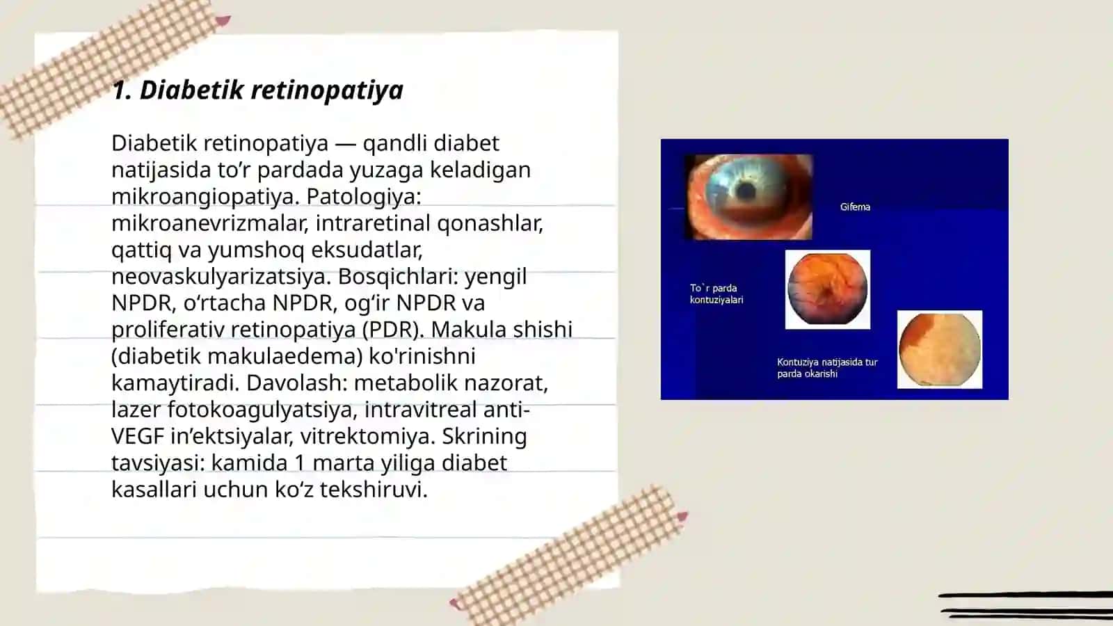 To’r parda va shishasimon tana kasalliklari 3