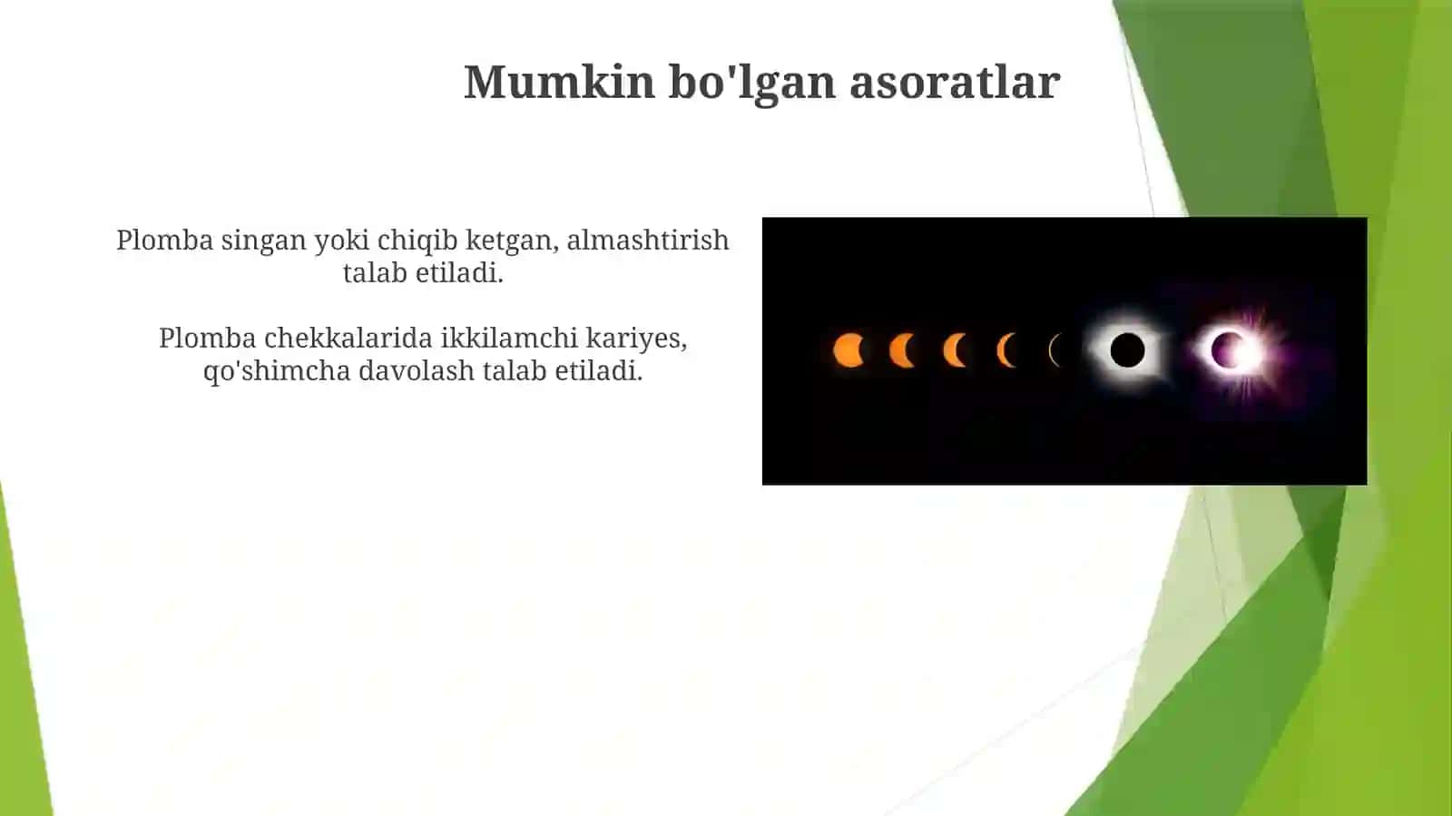 Kompozit plomba ashyolari haqida tushuncha 3