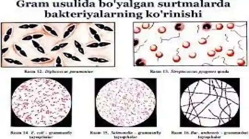 Biologik ashyoni bakterial kontaminasiyasini biokimyoviy usulda aniqlash.Hirurgik,akusher-ginekologik va unga yondosh bo'lgan bo'limlarni sanitar bakteriologik tekshirish va baho berish 3