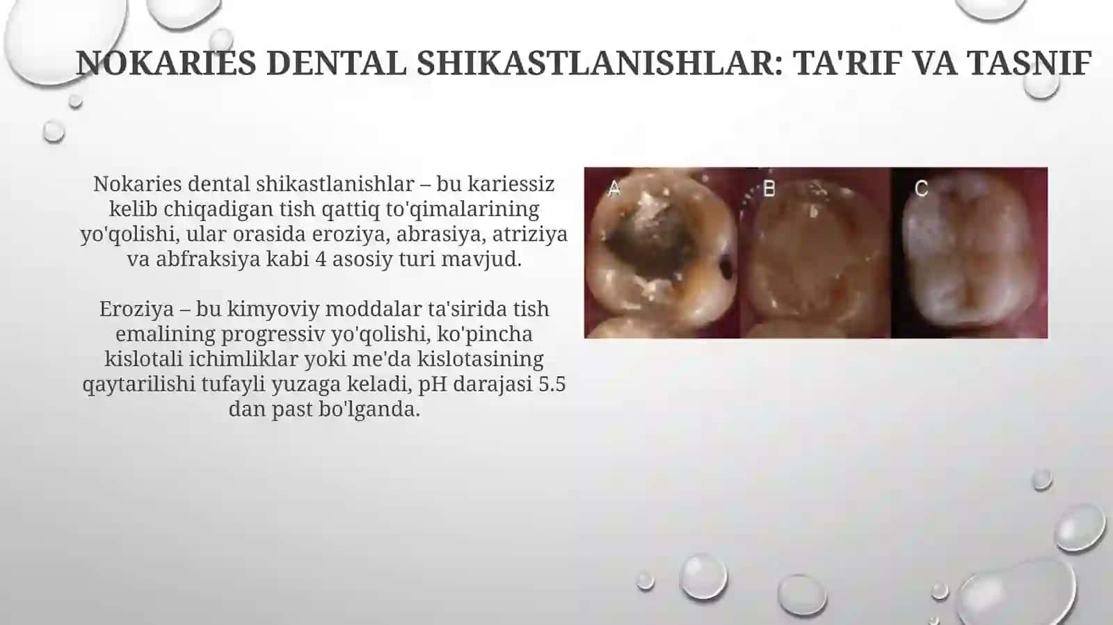 Nokarioz tish shikastlanishlari 3