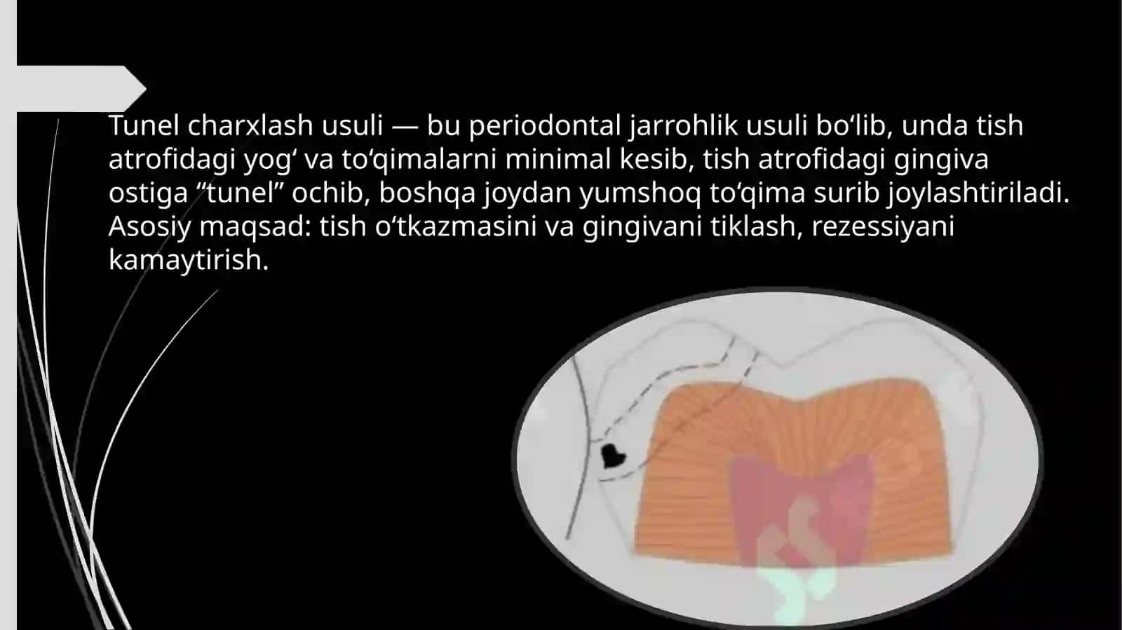 Tunel charxlash usuli 3