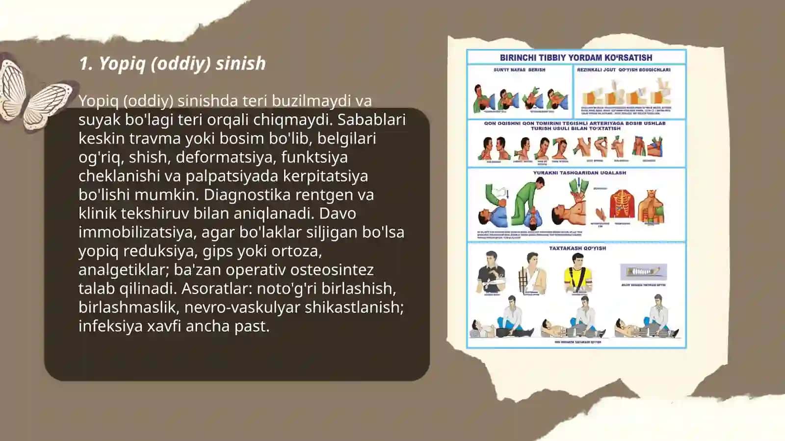 Sinishlar uning turlari 3