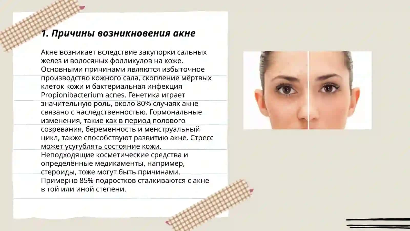 Кожа с акне 3