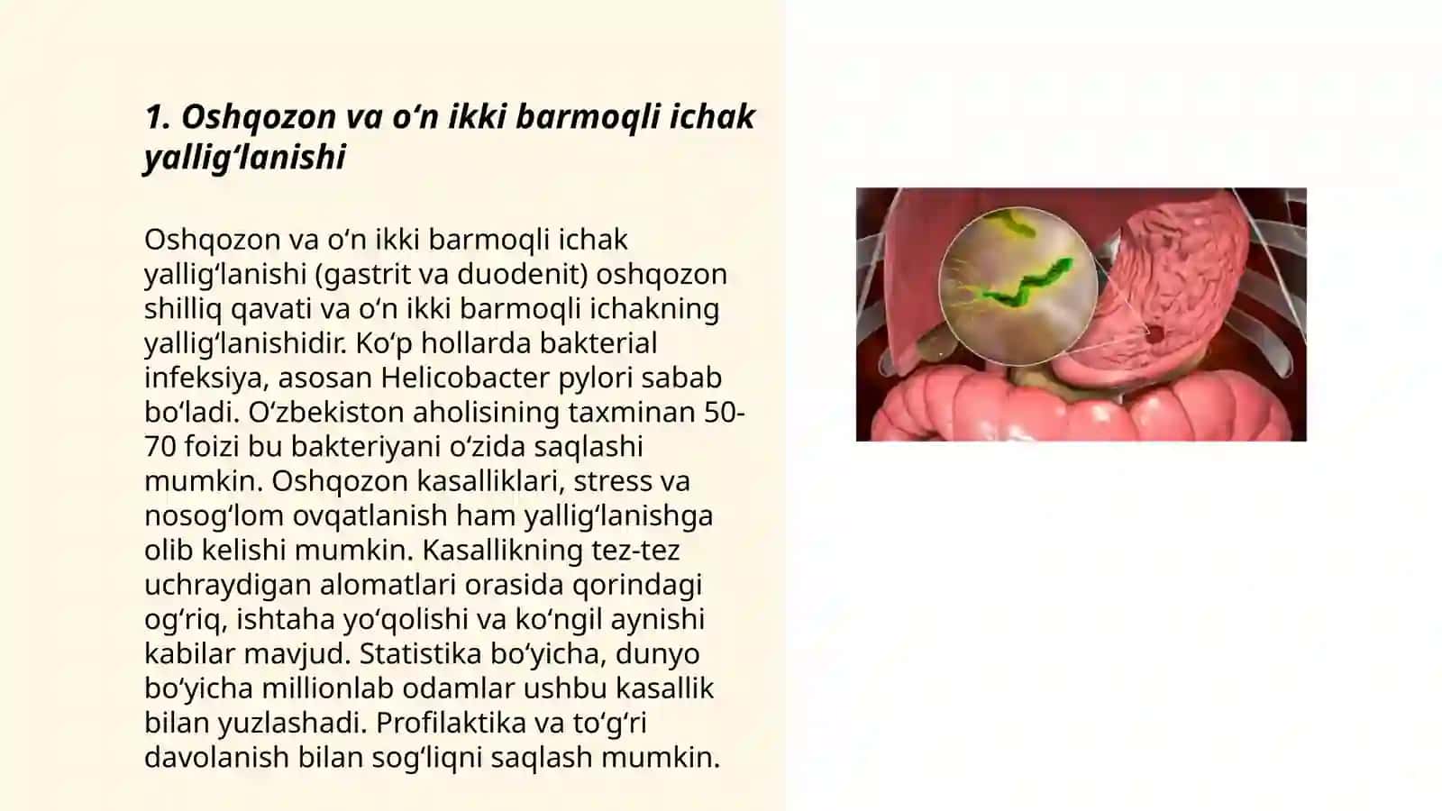 Oshqozon oʻn ikki barmoqli ichak kasalliklar 3