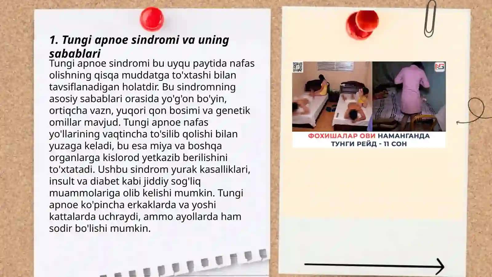 Tungi apnoe sindromi 3