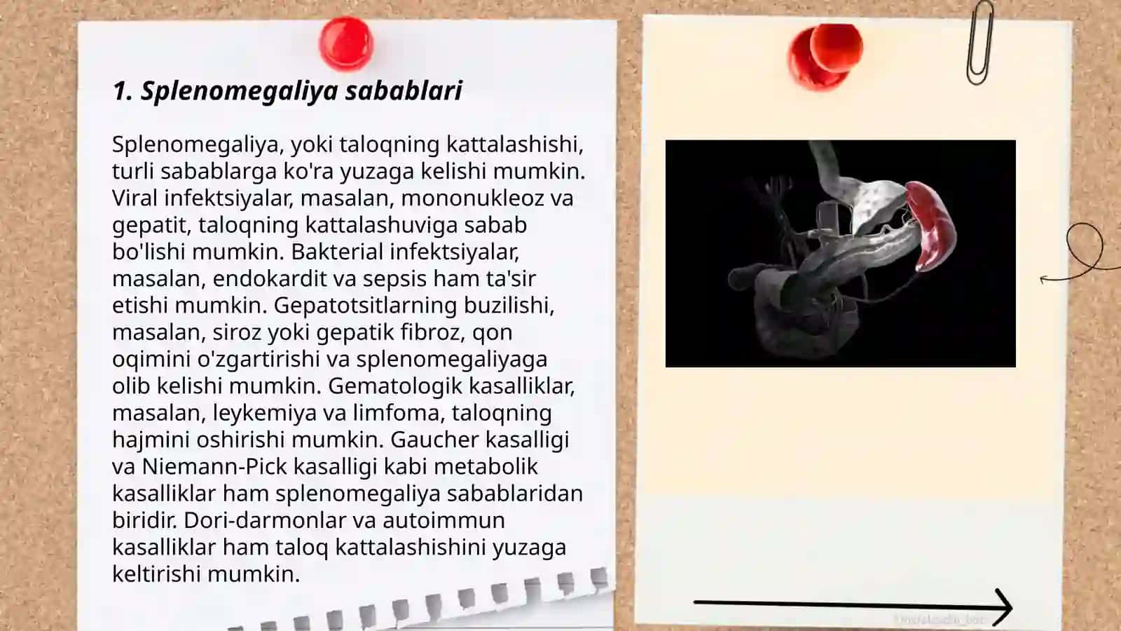 Splenomegaliya,gipersplenizm, funktsional aspleniya bilan kechadigan kasalliklar 3