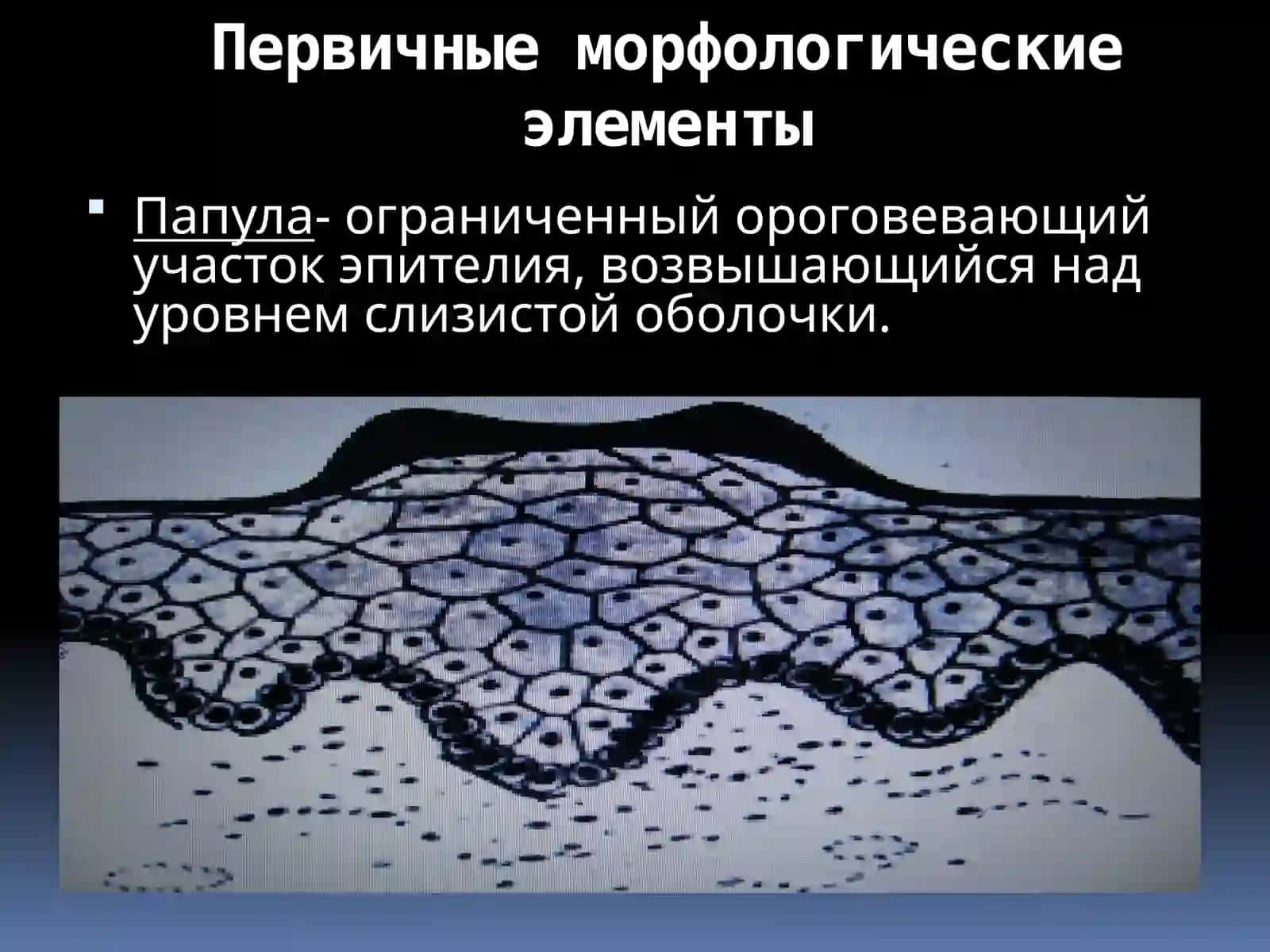 Заболевания слизистой оболочки и мягких тканей полости рта 3